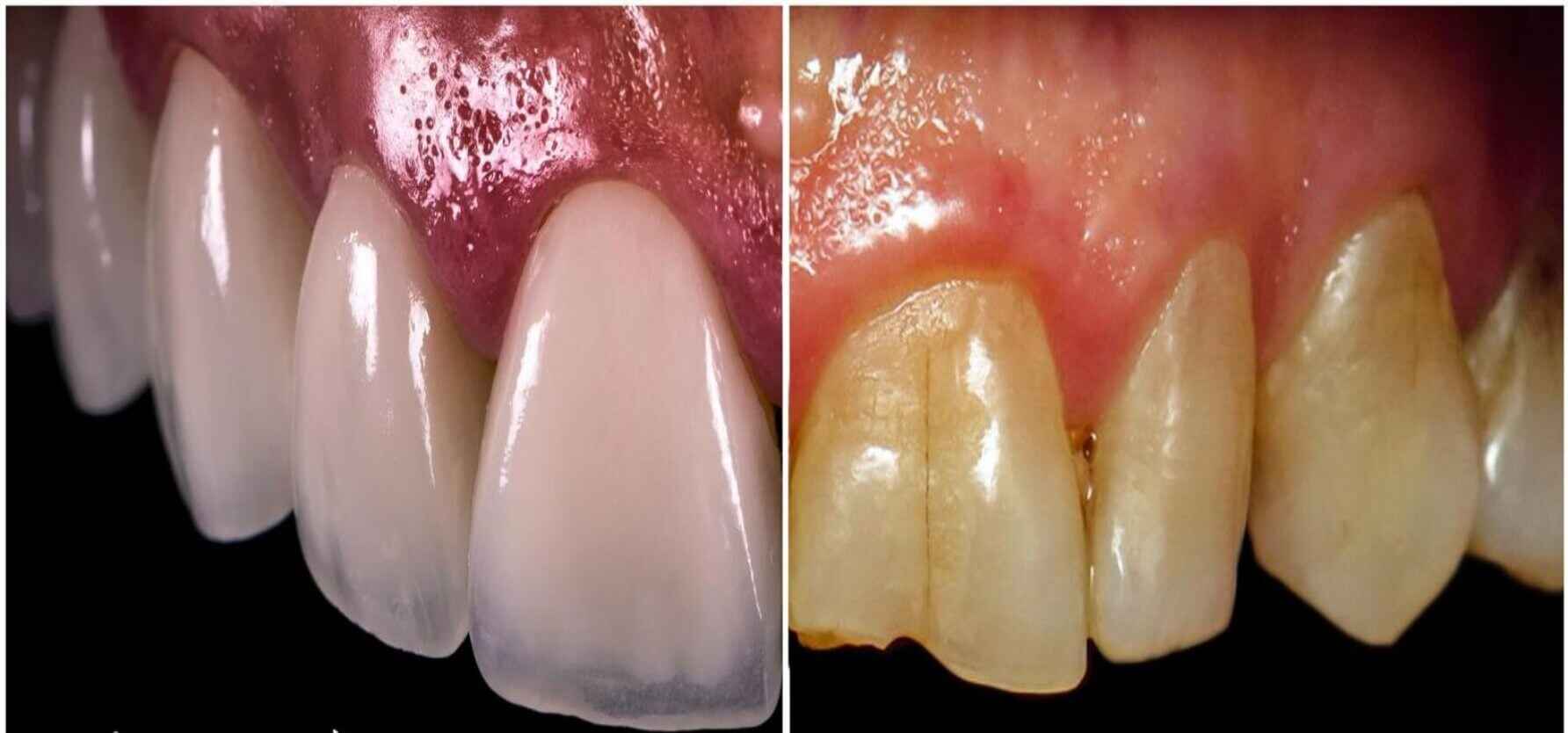 tratamiento2 clinica odontologica altata