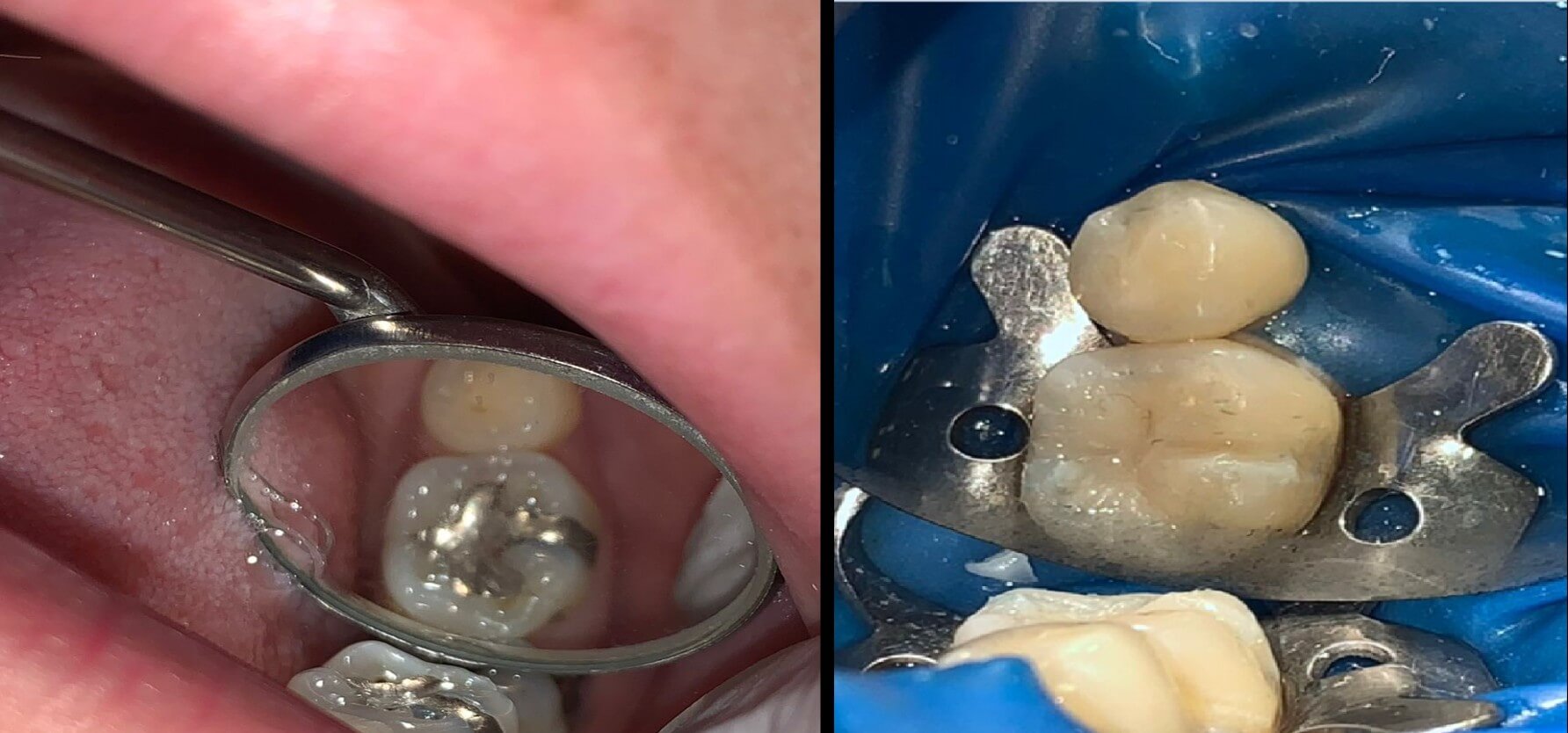 tratamiento11 clinica odontologica altata