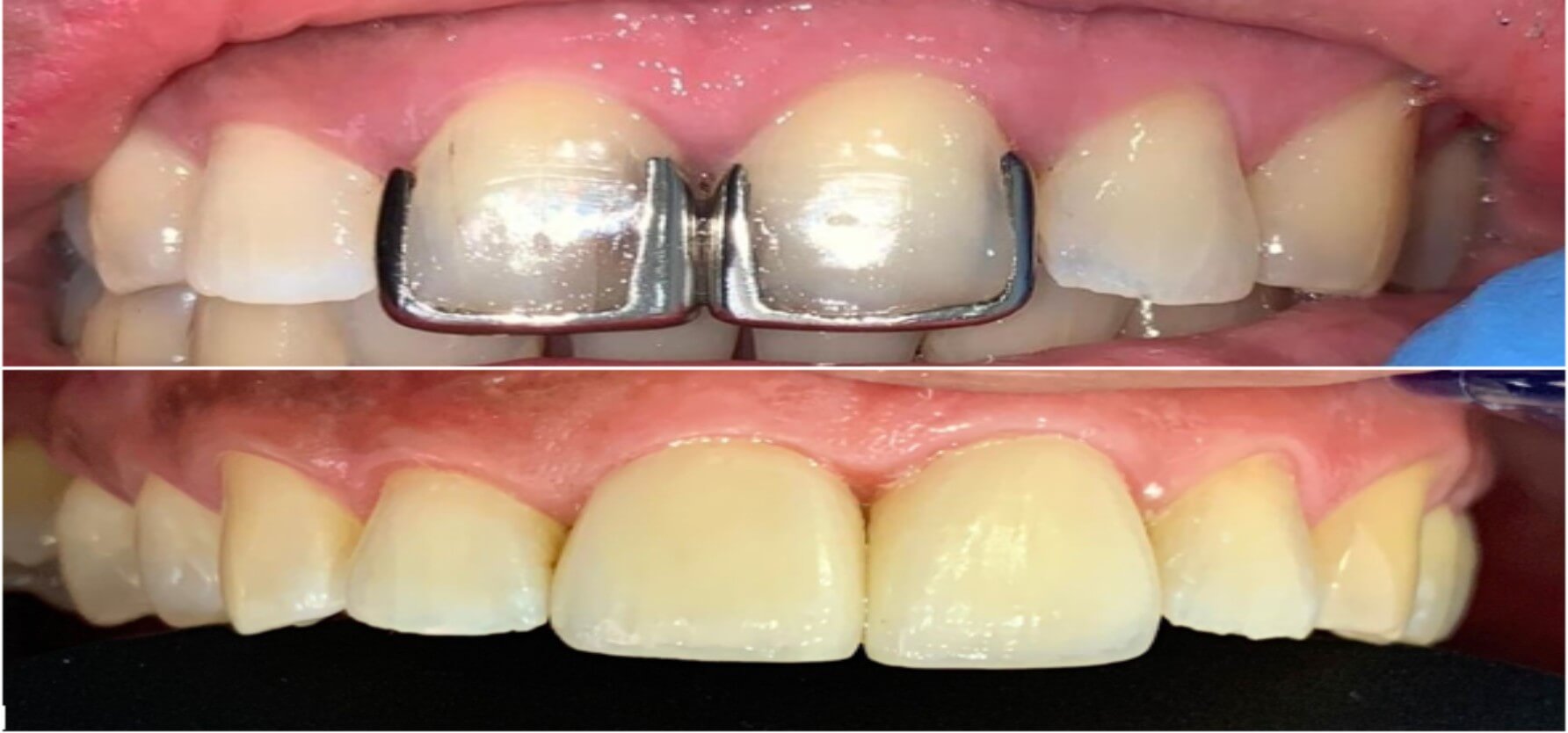 tratamiento16 clinica odontologica altata
