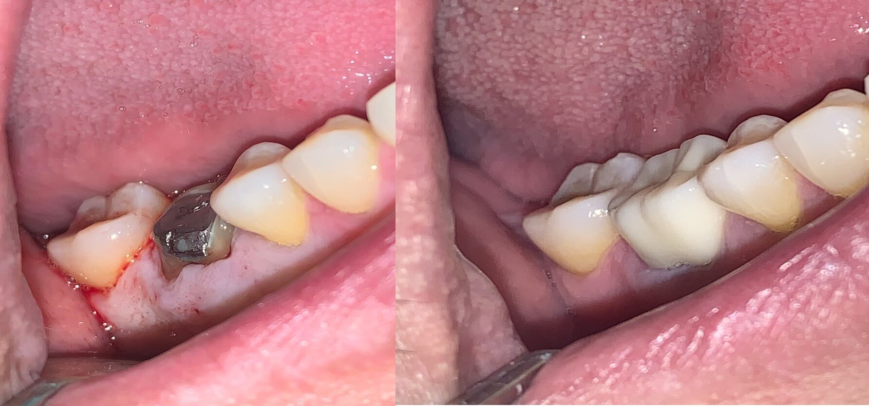 tratamiento19 clinica odontologica altata
